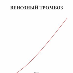 Венозный тромбоз