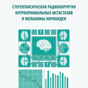 Стереотаксическая радиохирургия