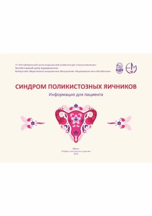 Синдром поликистозных яичников